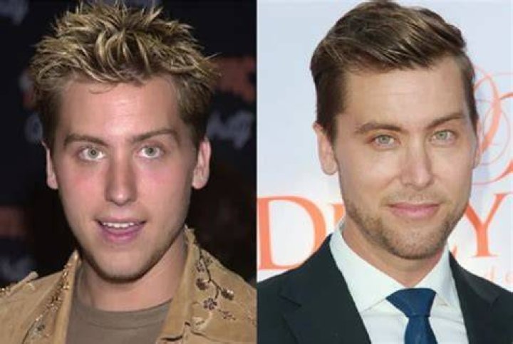 Did Lance Bass Had Nose Job Plastic Surgery Or Not