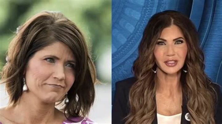  Discover The Transformation: Kristi Noem Before Plastic Surgery Revealed! 