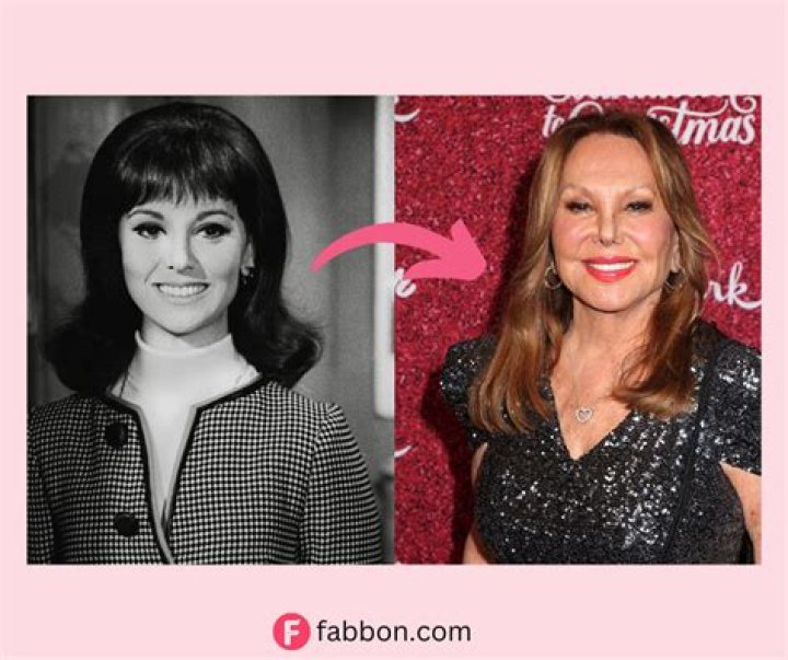 Marlo Thomas' Nose Transformation: Understanding The Changes