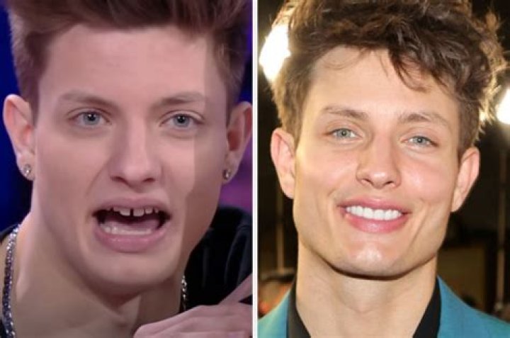 Matt Rife responds to plastic surgeon&rsquo;s claim he gave &lsquo;greatest jawline