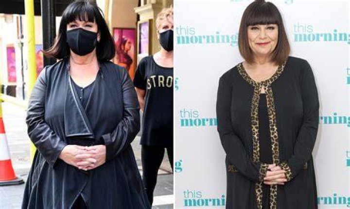 Shane Cruz Viral Dawn French Today