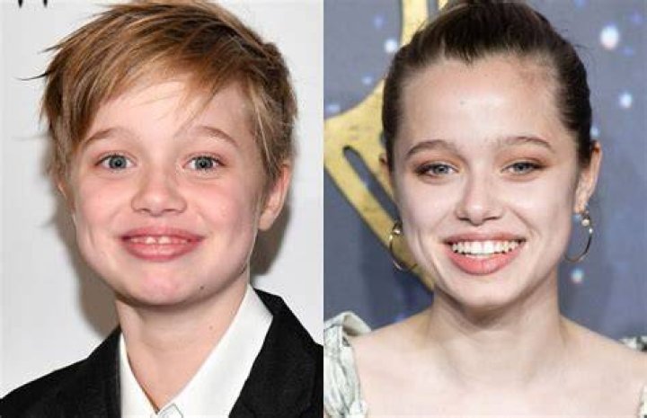 Shiloh Jolie Pitt Surgery