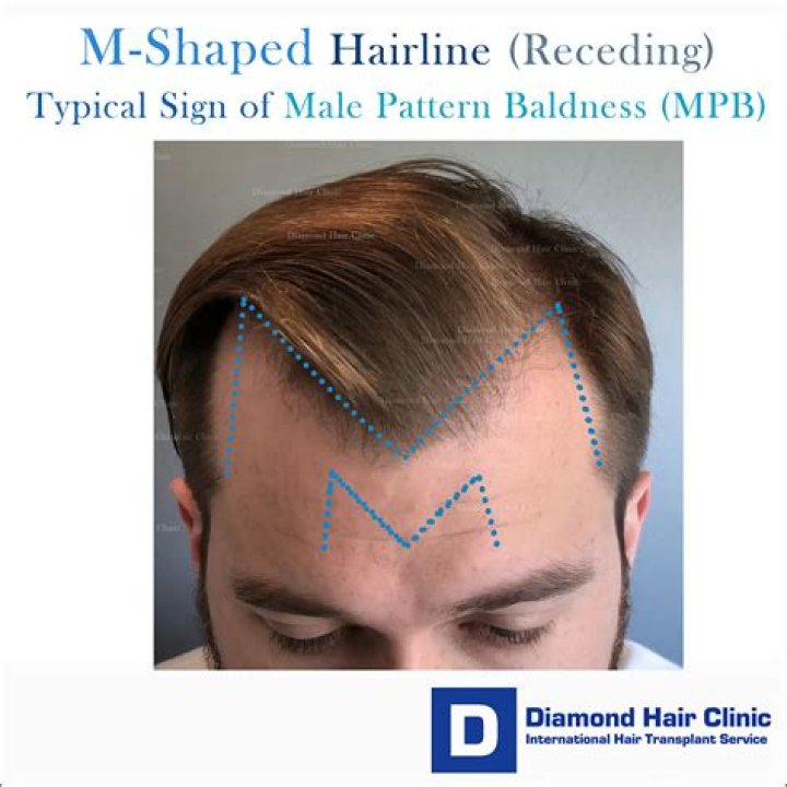Stream Receding Hairline Theme by Receding Hairline Listen online for