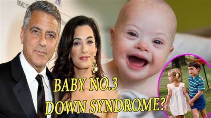 Unraveling The Truth: Do George Clooney's Twins Have Down Syndrome?