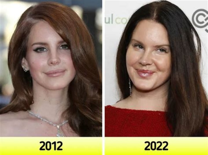 Unveiling The Truth Behind "Lana Del Rey Fat"