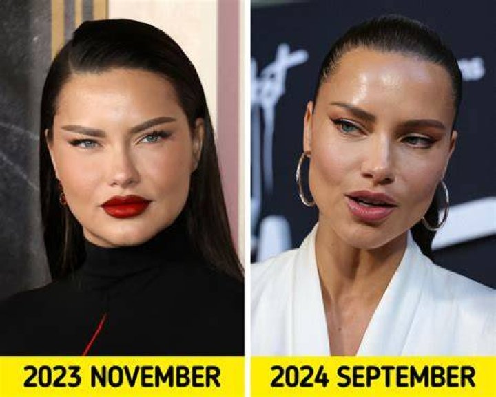Why Adriana Lima Really Got Divorced
